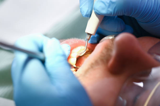 Best Emergency Dentist for Knocked-Out Tooth in Brightwood, VA