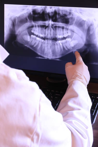 Best Emergency Dental Extractions in Brightwood, VA